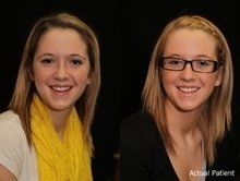 before and after dental fillings