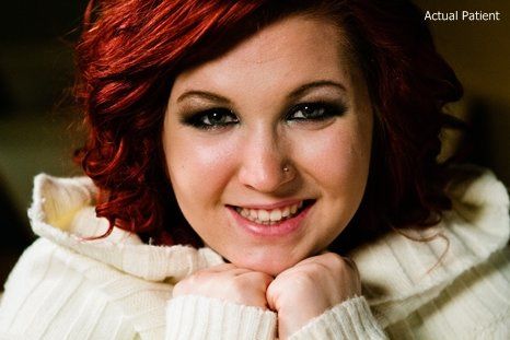 Smiling female dental patient with red hair