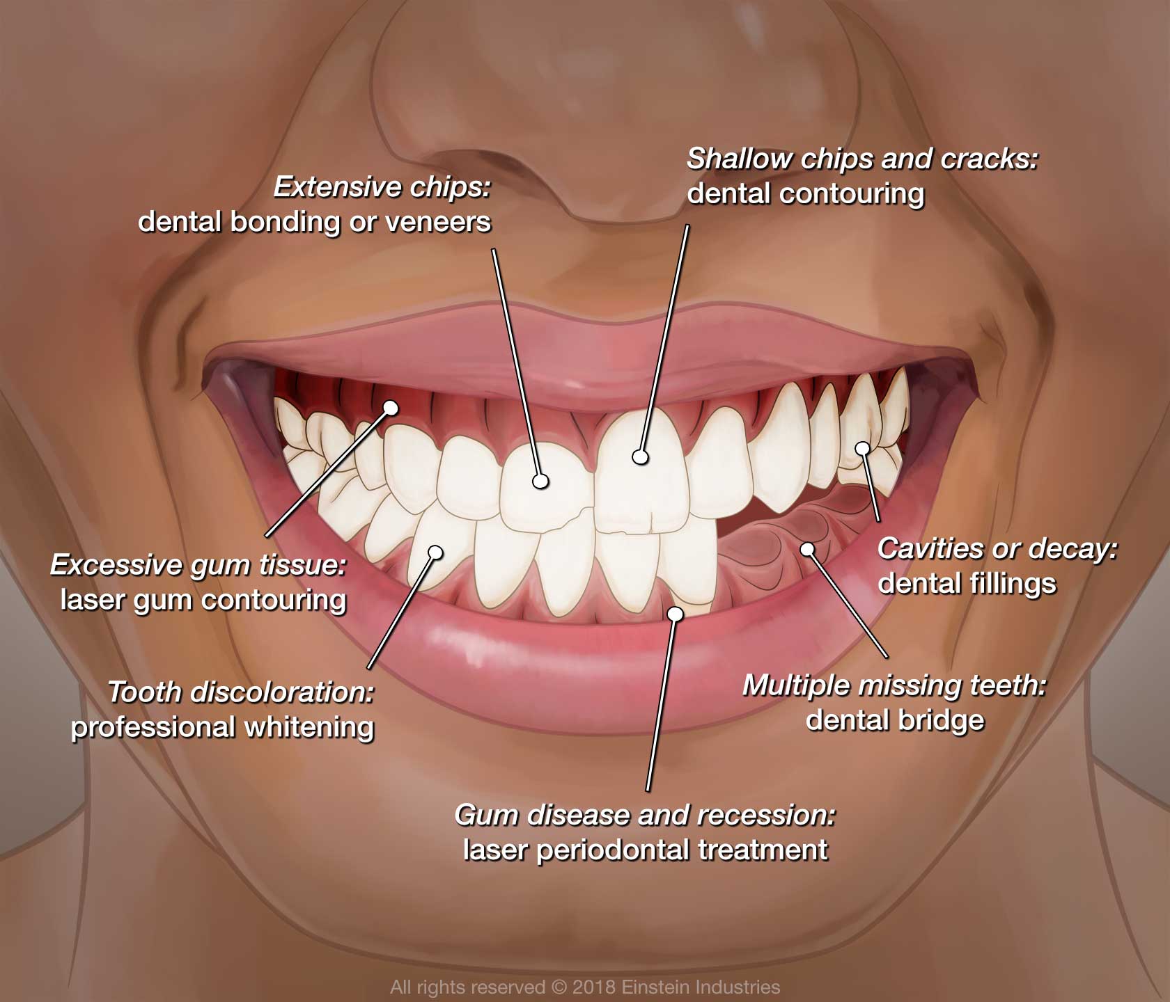 diagram of dental issues